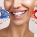 Retainers After Braces: Keep Your Smile Shining Bright!