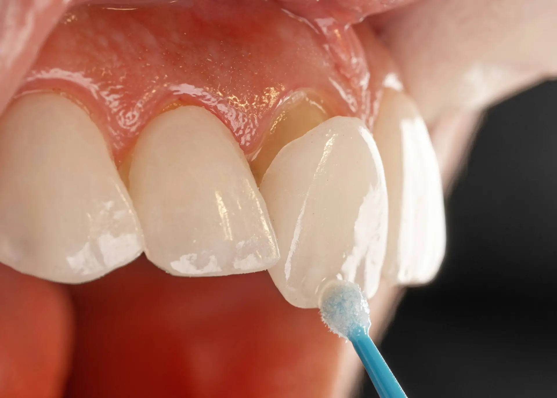 Cosmetic Dentistry