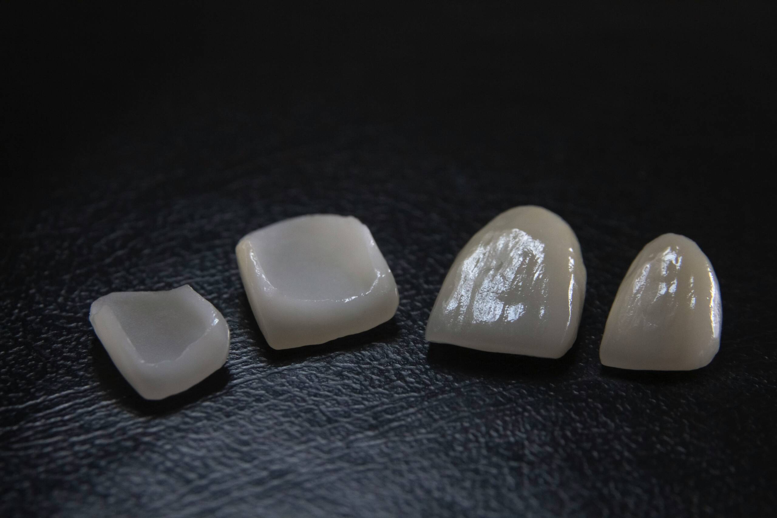 veneers