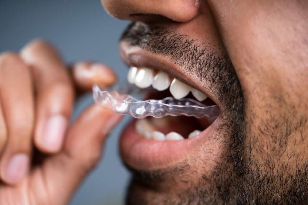 Aligners