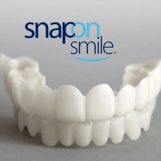 snap on veneers