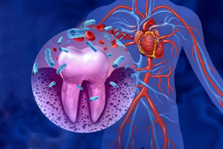 The Surprising Connection Between Your Oral Health and Heart Disease