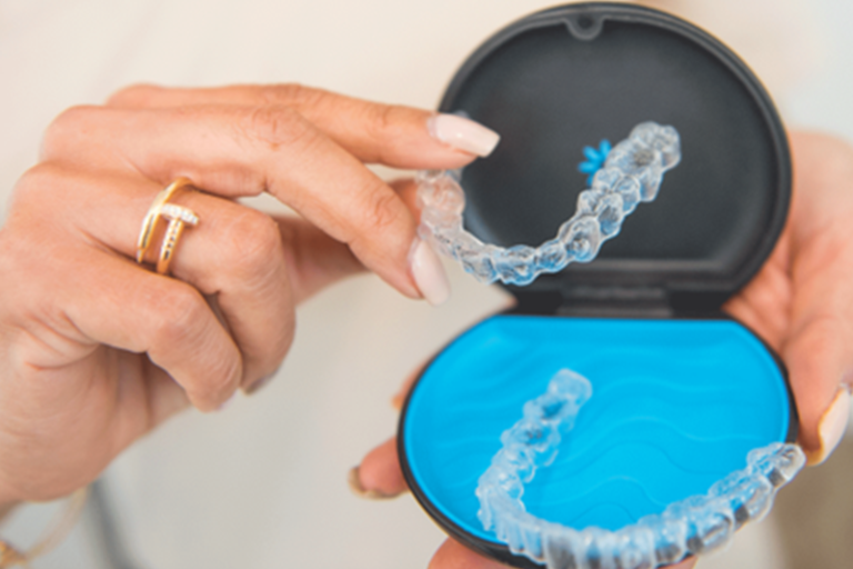 Invisible Braces: Your Secret Weapon for a Stunning Smile