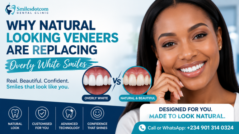 Why Natural-Looking Veneers Are Replacing Overly White Smiles