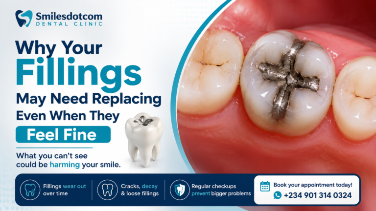 Why Your Fillings May Need Replacing Even When They Feel Fine | Smilesdotcom Dental Clinic