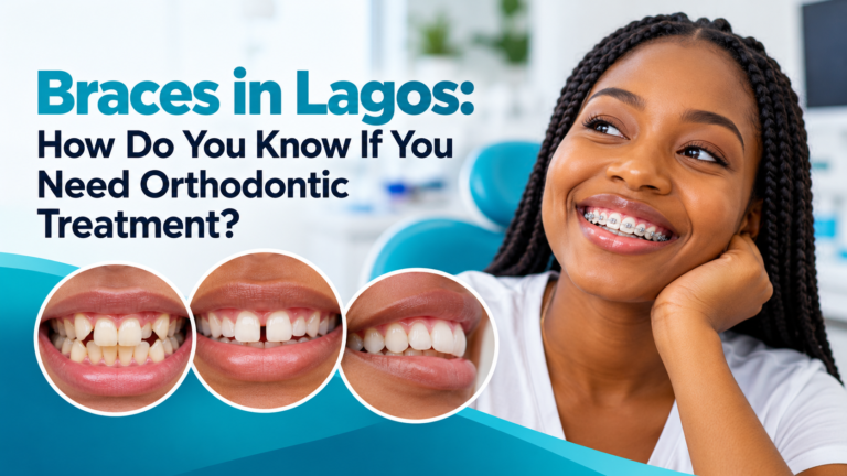 Braces in Lagos for correcting crowded teeth, gaps and bite alignment problems
